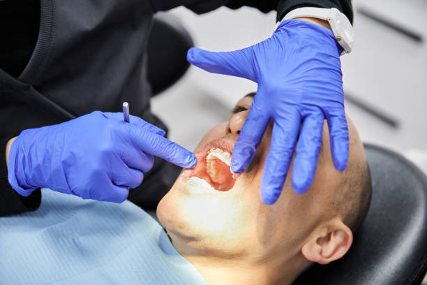 Best Teeth Whitening  in Wickes, AR